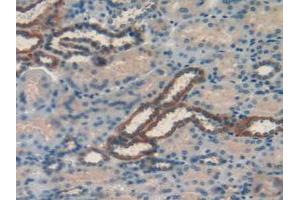 Figure. (RBP1 抗体  (AA 2-135))