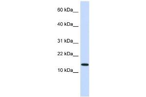 Western Blot showing NME1 antibody used at a concentration of 1 ug/ml against Fetal Heart Lysate (NME1 抗体  (N-Term))