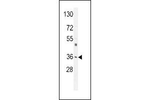 M6PR Antibody (C-term) (ABIN650726 and ABIN2839414) western blot analysis in A549 cell line lysates (35 μg/lane). (M6PR 抗体  (C-Term))