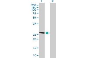 Western Blot analysis of TMED1 expression in transfected 293T cell line by TMED1 MaxPab polyclonal antibody. (TMED1 抗体  (AA 1-227))