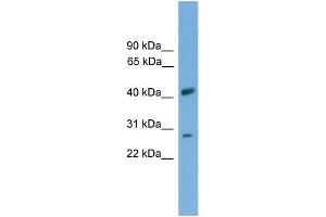 WB Suggested Anti-SLC25A37 Antibody Titration: 0. (SLC25A37 抗体  (Middle Region))