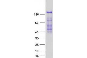 Validation with Western Blot (Ras Protein-Specific Guanine Nucleotide-Releasing Factor 2 (RASGRF2) protein (Myc-DYKDDDDK Tag))