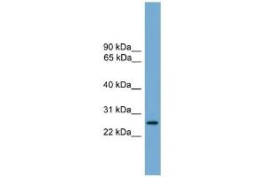 LRRC3 antibody used at 1 ug/ml to detect target protein. (LRRC3 抗体  (Middle Region))