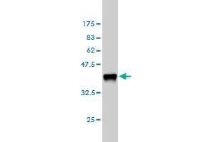 Western Blot detection against Immunogen (36. (M-CSF/CSF1 抗体  (AA 33-132))