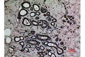 Immunohistochemistry (IHC) analysis of paraffin-embedded Human Breast, antibody was diluted at 1:100. (HMGB1 抗体  (acLys12))