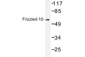 Image no. 1 for anti-Frizzled Family Receptor 10 (FZD10) antibody (ABIN317639) (FZD10 抗体)