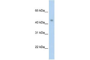 WB Suggested Anti-PRMT8 Antibody Titration:  2. (PRMT8 抗体  (C-Term))