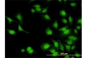 Immunofluorescence of monoclonal antibody to IRAK1 on HeLa cell. (IRAK1 抗体  (AA 530-693))