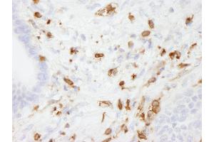 anti-Coronin, Actin Binding Protein, 1A (CORO1A) (AA 250-300) antibody