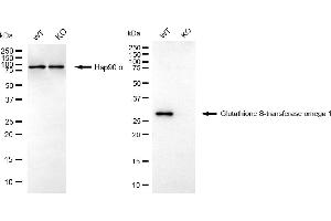 Western blotting analysis using glutathione S-transferase omega 1 antibody (ABIN7798757). (Recombinant GSTO1 抗体)
