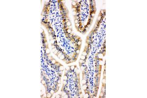 Anti-Peroxiredoxin 3 antibody, IHC(P) IHC(P): Rat Intestine Tissue