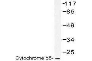 Western blot (WB) analysis of Cytochrome b5 antibody in extracts from A549 cells. (CYB5R3 抗体)