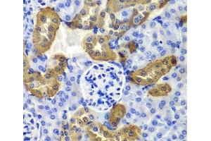 Immunohistochemistry of paraffin-embedded Mouse kidney using KRT19 Polyclonal Antibody at dilution of 1:100 (40x lens). (Cytokeratin 19 抗体)