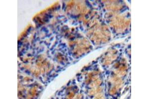 Used in DAB staining on fromalin fixed paraffin-embedded Bowels tissue (TPSD1 抗体  (AA 99-191))