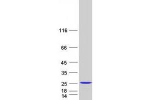 Western Blotting (WB) image for RAP2B, Member of RAS Oncogene Family (RAP2B) protein (Myc-DYKDDDDK Tag) (ABIN2730479)