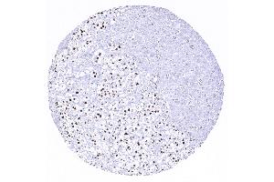 Strong INSM1 immunostaining of medullar but not cortical cells of the adrenal gland (Recombinant INSM1 抗体  (AA 81-125))