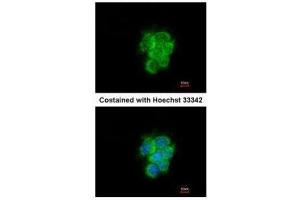 ICC/IF Image Immunofluorescence analysis of methanol-fixed A431, using MIPEP, antibody at 1:200 dilution. (MIPEP 抗体)