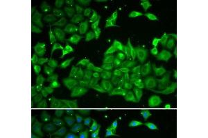 Immunofluorescence analysis of HeLa cells using ALDH3A1 Polyclonal Antibody (ALDH3A1 抗体)