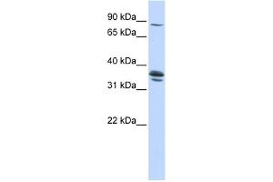 Western Blotting (WB) image for anti-Solute Carrier Organic Anion Transporter Family, Member 3A1 (SLCO3A1) (Middle Region) antibody (ABIN2781632)