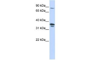 WB Suggested Anti-SLCO3A1 Antibody Titration:  0. (Solute Carrier Organic Anion Transporter Family, Member 3A1 (SLCO3A1) (Middle Region) 抗体)