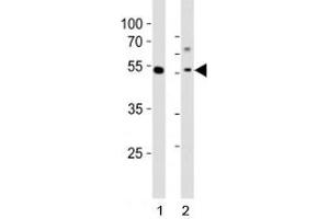 Western blot analysis of lysate from 1) human MCF-7 cell line and 2) mouse liver tissue tissue using Gata6 antibody at 1:1000. (GATA6 抗体  (C-Term))