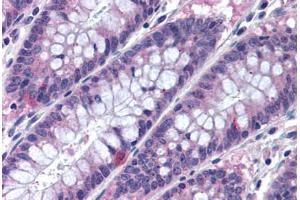 Human Colon (formalin-fixed, paraffin-embedded) stained with MTSS1 antibody ABIN290367 at 10 ug/ml followed by biotinylated goat anti-rabbit IgG secondary antibody ABIN481713, alkaline phosphatase-streptavidin and chromogen. (MTSS1 抗体  (AA 670-720))