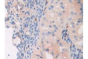Immunohistochemistry (IHC) image for anti-Myosin, Light Chain 3 (MYL3) (AA 8-199) antibody (ABIN7443521)