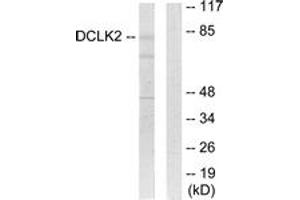 Western blot analysis of extracts from HepG2 cells, using DCLK2 Antibody.