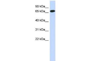 WB Suggested Anti-C1orf65 Antibody Titration: 0. (C1orf65 抗体  (N-Term))