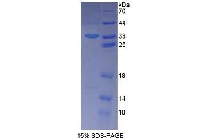 SDS-PAGE analysis of Human SLFN5 Protein. (SLFN5 蛋白)
