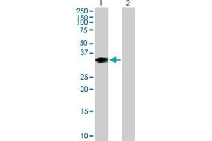 Western Blot analysis of ARL10 expression in transfected 293T cell line by ARL10 MaxPab polyclonal antibody. (ARL10 抗体  (AA 1-276))