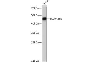 Western blot analysis of extracts of HeLa cells, using SLC9R2 antibody (ABIN7270487) at 1:1000 dilution. (SLC9A3R2 抗体  (AA 180-300))