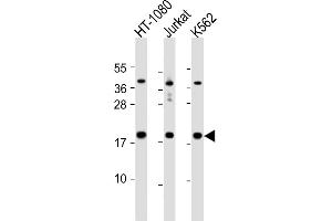 All lanes : Anti-NAT13 Antibody (C-term) at 1:1000 dilution Lane 1: HT-1080 whole cell lysate Lane 2: Jurkat whole cell lysate Lane 3: K562 whole cell lysate Lysates/proteins at 20 μg per lane. (NAA50 抗体  (C-Term))