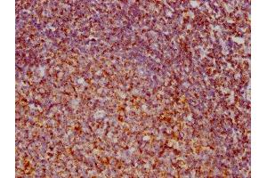 Immunohistochemistry (IHC) image for anti-Voltage-Dependent Anion Channel 1 (VDAC1) antibody (ABIN7127868)