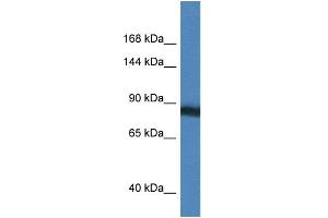 WB Suggested Anti-SEMA4D Antibody Titration: 1. (SEMA4D/CD100 抗体  (N-Term))