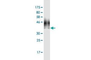 Western Blot detection against Immunogen (39. (RPS2 抗体  (AA 47-170))
