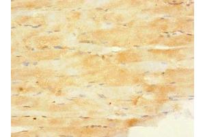 Immunohistochemistry of paraffin-embedded human skeletal muscle tissue using ABIN7165932 at dilution of 1:100