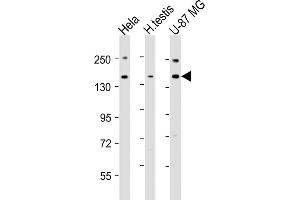 All lanes : Anti-USP47 Antibody (Center) at 1:2000 dilution Lane 1: Hela whole cell lysates Lane 2: human testis lysates Lane 3: U-87 MG whole cell lysates Lysates/proteins at 20 μg per lane. (USP47 抗体  (AA 588-620))