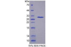 SDS-PAGE (SDS) image for alpha-2-Macroglobulin (A2M) (AA 157-389) protein (His tag) (ABIN2120519)