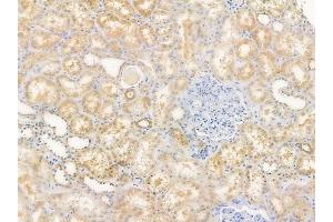 ABIN6262286 and ABIN6279485 at 1/100 staining human normal kidney tissue by IHC-P.
