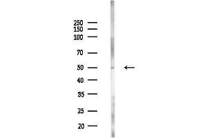 anti-Heat shock factor protein 2 (HSF2) (Internal Region) antibody