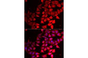 Immunofluorescence analysis of MCF7 cells using CMPK1 antibody. (Cytidine Monophosphate (UMP-CMP) Kinase 1, Cytosolic (CMPK1) (AA 69-228) 抗体)
