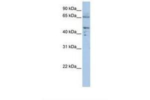 Image no. 1 for anti-Dihydrolipoyl Transacetylase (DLAT) (AA 540-589) antibody (ABIN6738015) (DLAT 抗体  (AA 540-589))