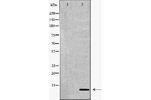 Western blot analysis of A375  lysate using S100B antibody. (S100B 抗体  (C-Term))