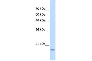 WB Suggested Anti-YAF2 Antibody Titration: 1. (YAF2 抗体  (Middle Region))