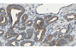 ABIN6275494 at 1/100 staining Human prostate tissue by IHC-P. (ARHGEF10 抗体  (Internal Region))