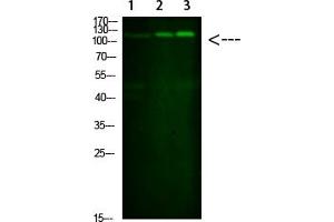 Western Blot analysis of 1, Mouse-liver 2, hela 3,Mouse-brain cells using primary antibody diluted at 1:1000 (4 °C overnight).