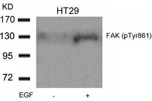 Western blot analysis of extracts from HT29 cells untreated or treated with EGF using FAK(Phospho-Tyr861) Antibody. (FAK 抗体  (pTyr861))