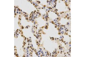 Immunohistochemistry (Paraffin-embedded Sections) (IHC (p)) image for anti-Histone 3 (H3) (H3K36me2) antibody (ABIN3016036)