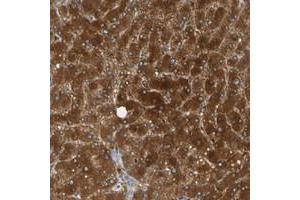Immunohistochemical staining of human liver with PARP14 polyclonal antibody  shows strong cytoplasmic positivity in hepatocytes at 1:50-1:200 dilution. (PARP14 抗体)